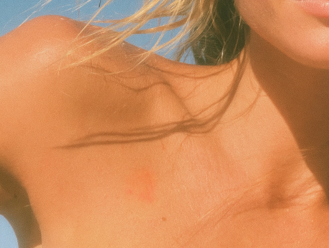 Sunscreen for Sensitive Skin: Why Zinc Oxide Works