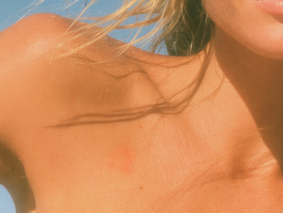 Sunscreen for Sensitive Skin: Why Zinc Oxide Works